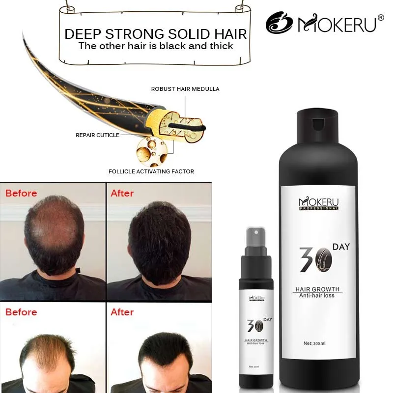 Mejor La Pérdida De Cabello Productos Para Ayudar A Rápido