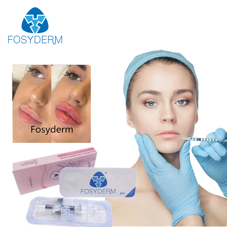 

Fosyderm 2ml Lip Fillers Hyaluronic Acid Injection Dermal Injectable Fillers, Transparent