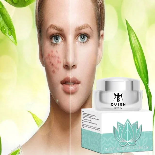 

Private label deep scar burn scar removal cream, White color