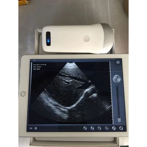 What does a hookup ultrasound do