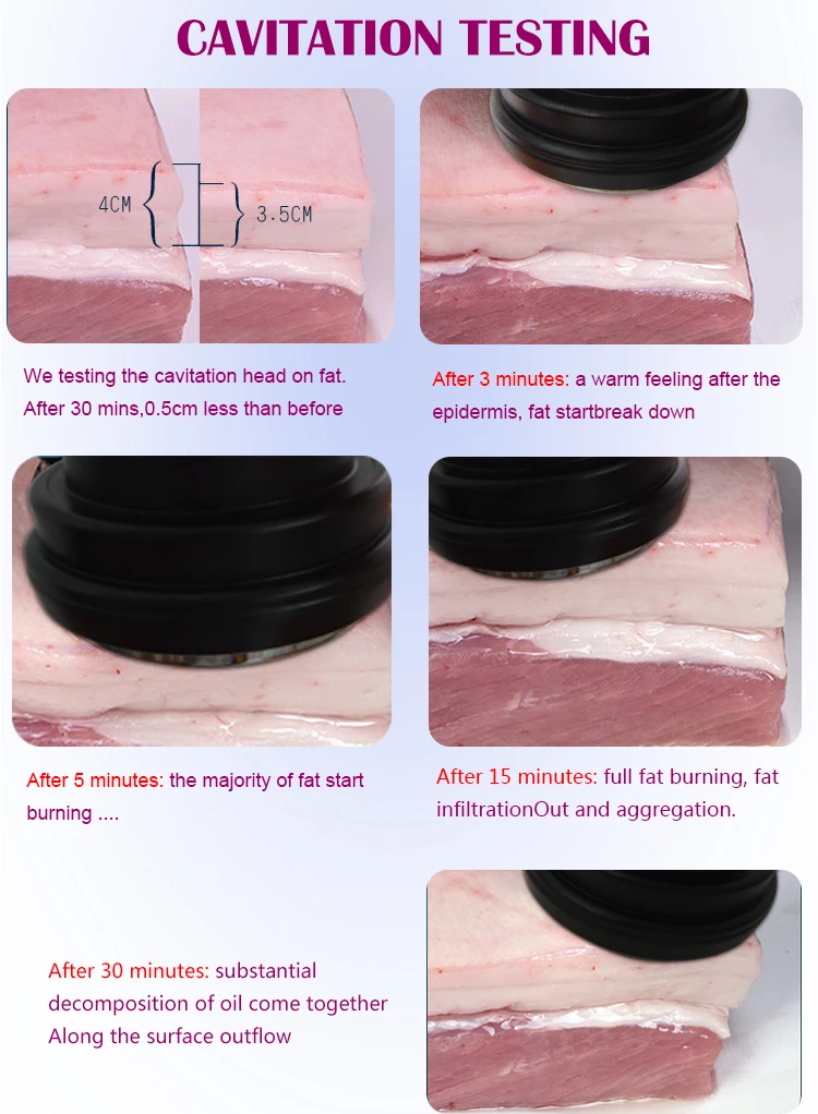 B0105 Portable Medical Ultra Cavitataion RF Vacuum Weight Loss Slimming Machine For Sale