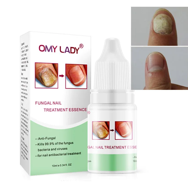 

Balala nail foot protector nail fungus treatment nail repair, Clear