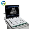 IN-A032China cheap hot sale high quality notebook portable popular ultrasonic 3d b mode mobile ultrasound machine price for sale