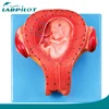 Third Month Fetus/Embryo Model,Embryonic anatomical model