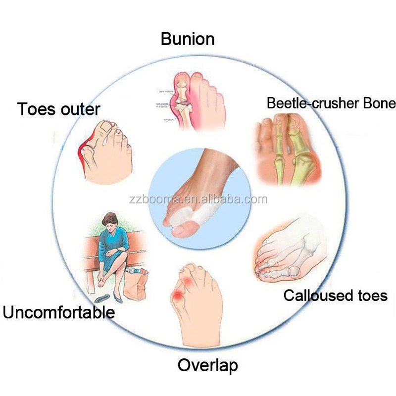 Gel silicone toe separator