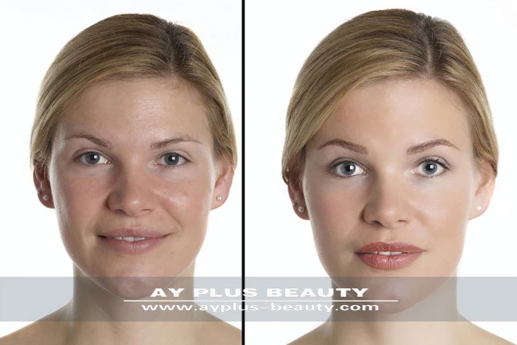 skin peeling machine.jpg