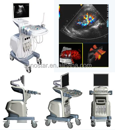 
Color Ultrasound Doppler Machine with Trolley SS 2000 Sonostar Manufacturer 