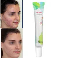 

OEM/ODM 100% Chinese Herbal Medicine To Extract Acne Cream, Acne Scar Removal Cream