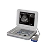 Gynecological pregnancy examination device portable ultrasound scanner