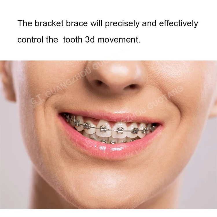 - Buy Dental Orthodontic Bracket,Orthodontic Metal Korea Product on Alibaba.com