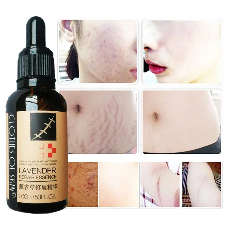 scar repair liquid (2).jpg