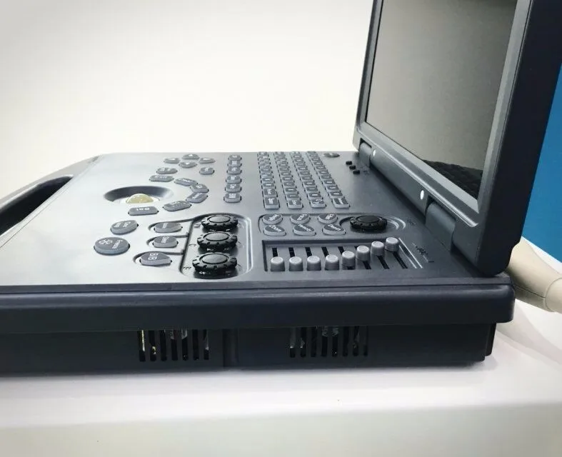 China Wireless Portable Ultrasound Machine For Pregnancy