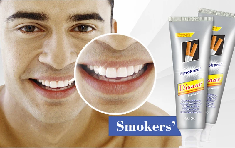 teeth whitening (8).jpg