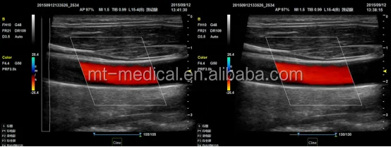 2017 New Portable Laptop Ultrasonic Diagnostic Devices Type ultrasound machine
