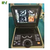 /product-detail/mslcu28w-cheap-portable-4d-color-doppler-ultrasound-60350539616.html