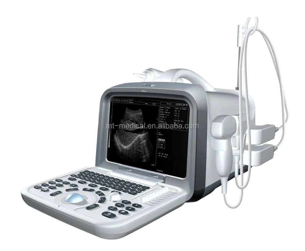 Portable Devices Micro-convex Ultrasonic Scanner Ultrasonic Diagnostic Scanner