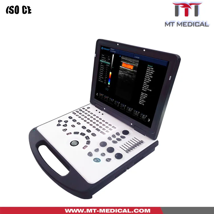 Portable 3D Doppler Ultrasound Machine Ultrasonography