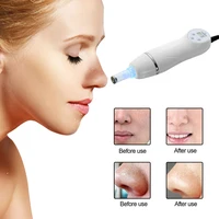 

portable diamond microdermabrasion tips/diamond microdermabrasion peel machine hot sale