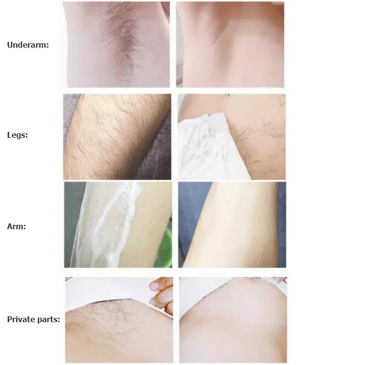 QIANSOTO brand Natural extraction reduces face hair and body hair natural extraction Painless hair removal essence liquid