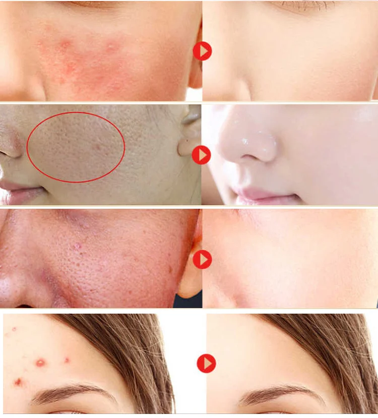 Aichun Beauty Organic Facial Care Blackhead Remove Oil-Control Charcoal Bamboo Face Black mask