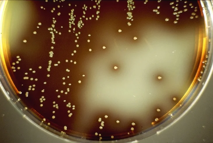 Resultado de imagen para listeria oxford agar