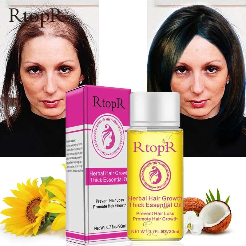 Naturals  Advanced Topical Formula to Help Grow Healthy, Strong Hair  Suitable Hair Growth Serum   For Men & Women