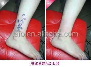 before,after.jpg
