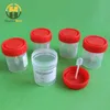Various Medical Consumable Stool Container medical stool sample cup for hospita and lab test stool