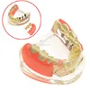 Medical College Dental Study / Teaching / Training Tooth Plant Model