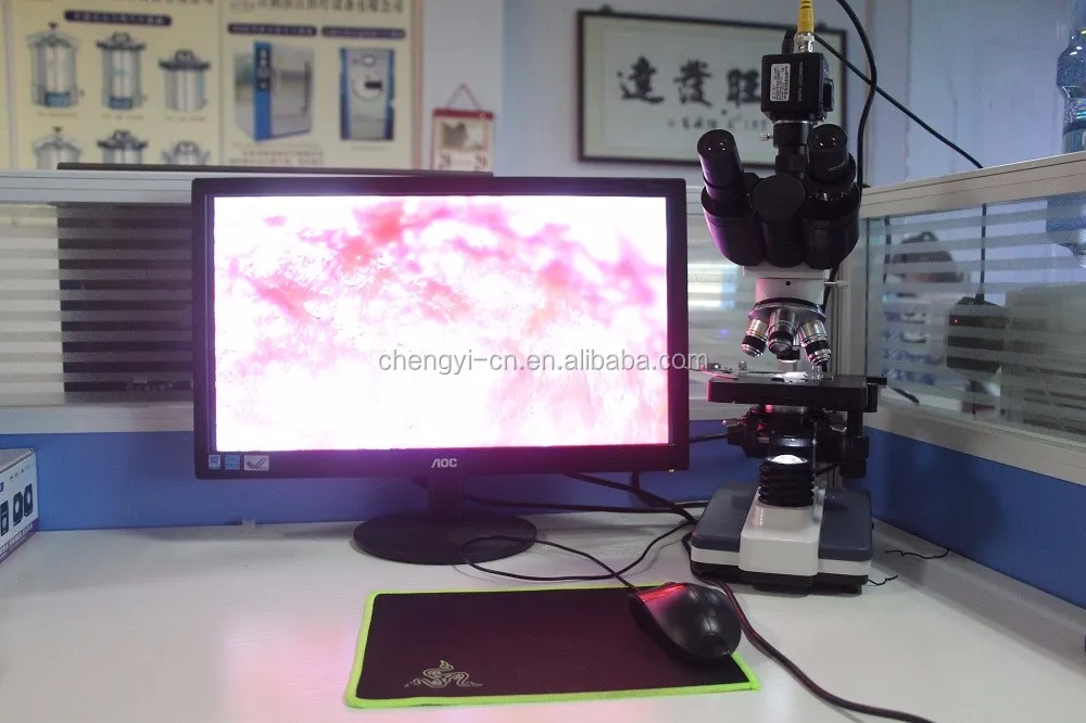 Xsp200sm Binocular Microscope Professional Detector For Blood/sperm