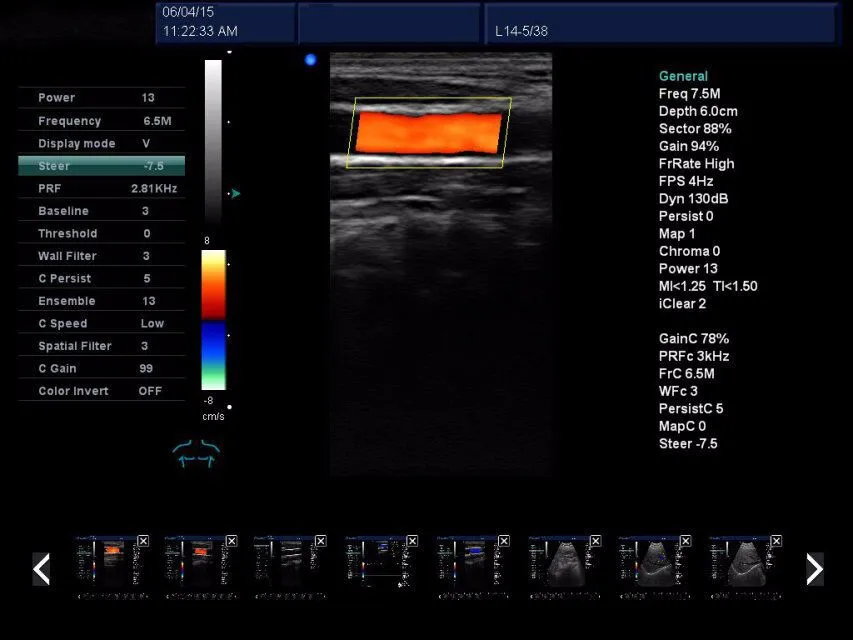 China Wireless Portable Ultrasound Machine For Pregnancy