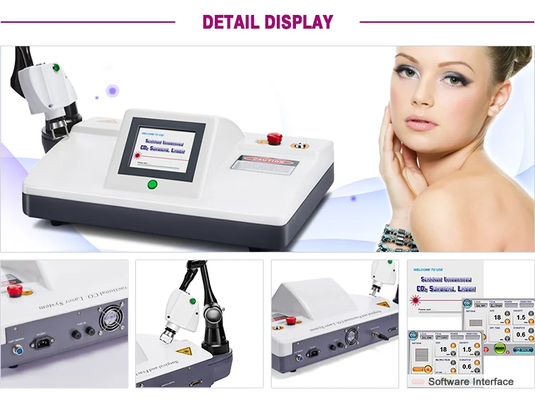 Detail display_15CF+