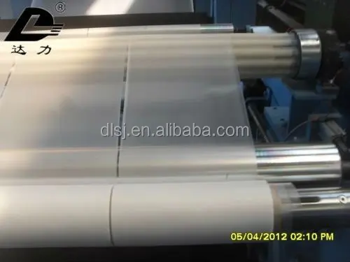 
medical gloves film production line 