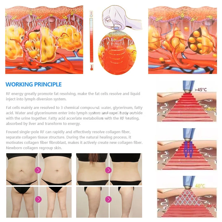 Weight Loss Feature and CE Certification fat freeze slimming machine