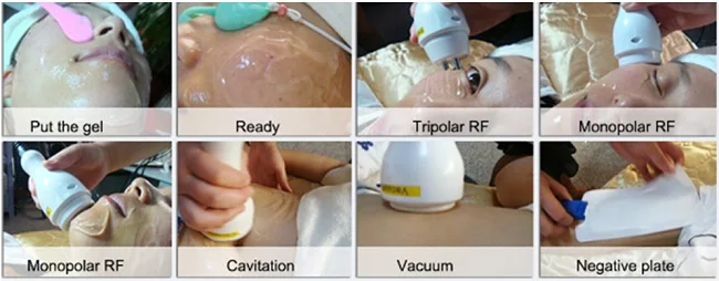 body shape radio frequency skin tightening vacuum cavitation rf slimming.JPG