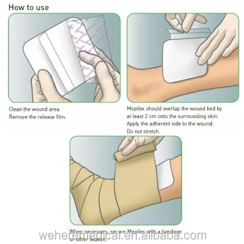 High quality Silicone Foam dressing for wound care with FDA, CE, ISO ...