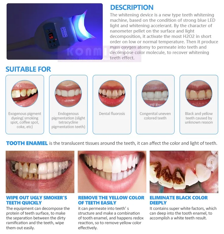 Home Use Teeth Care Teeth Whitening Machine Cold Light Led Light Teeth Whitening Kits Buy Cold