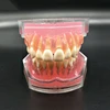 Stomatology teaching practice tooth extraction disassembly tooth model dental study model