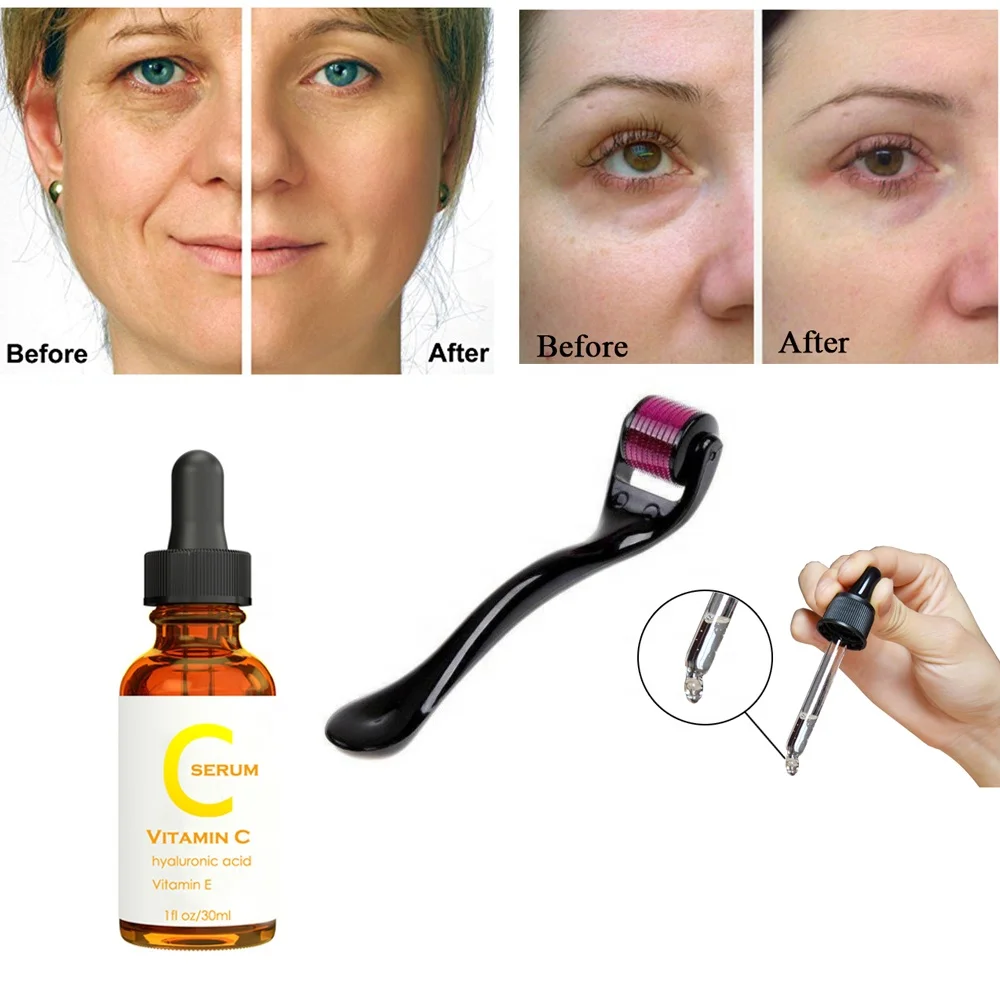 Derma-Roller-Kit-540.jpg