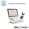 Automatic Semen Analysis System CASA Sperm Quality Analyzer Software