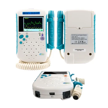 condiciones vasculares de ultrasonidos