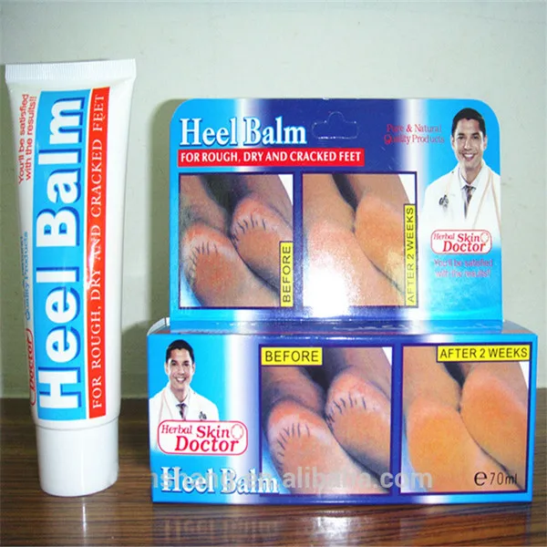 

Hot selling foot care dry feet treatment Stiff, dead skin and calluses Cure Heel Balm