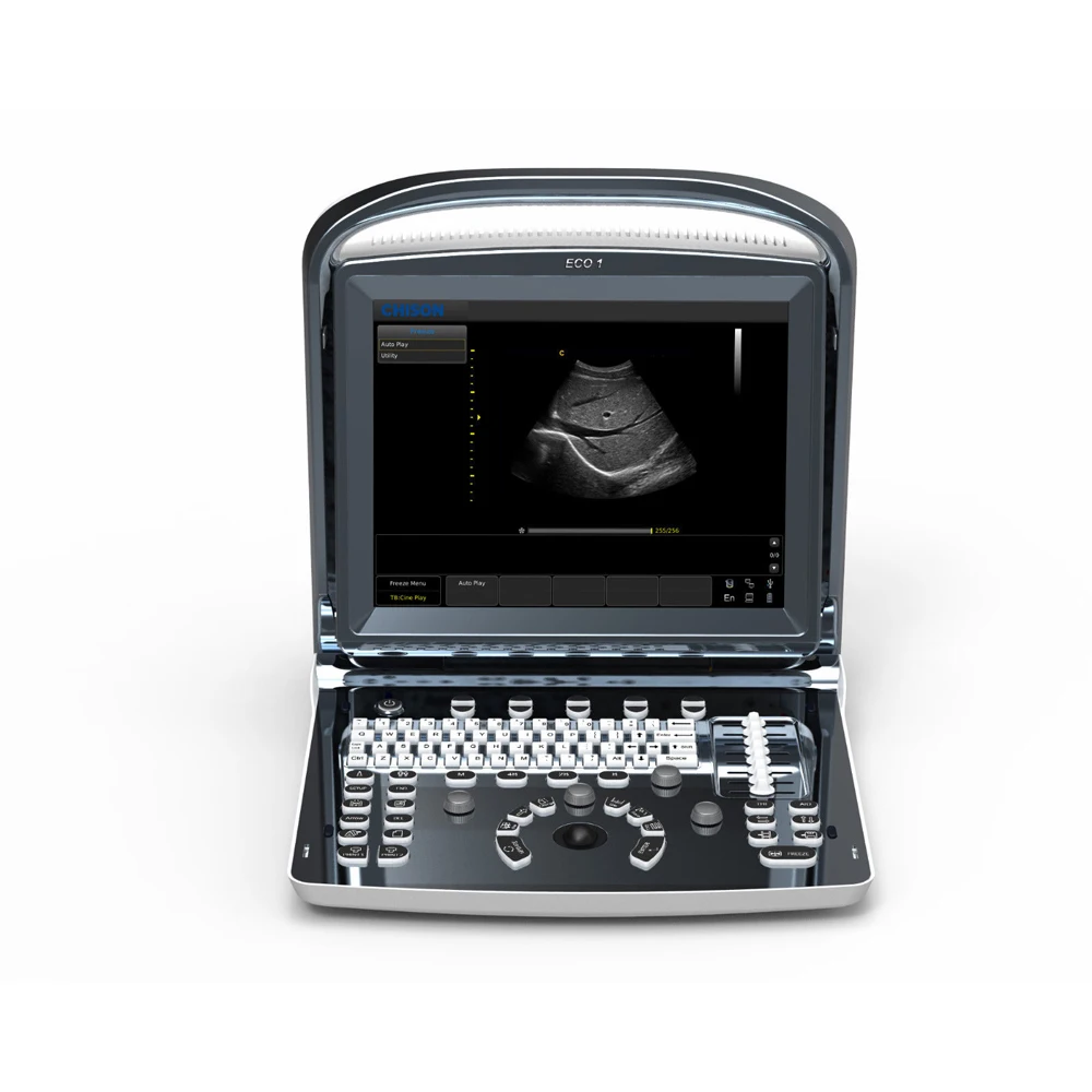 Chison Eco1 Portable Ultrasound Machine For Pregnancy Buy Ultrasound