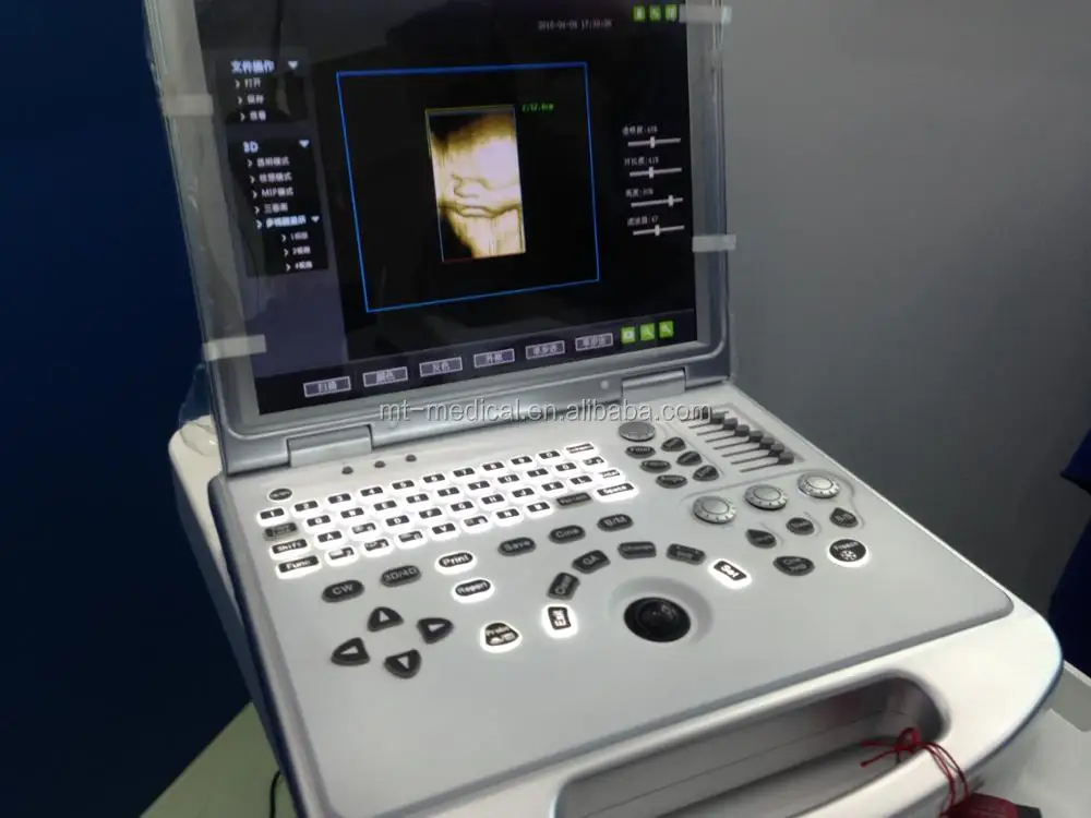 Digital Portable Ultrasound Scanner Diagnostic System For Sale