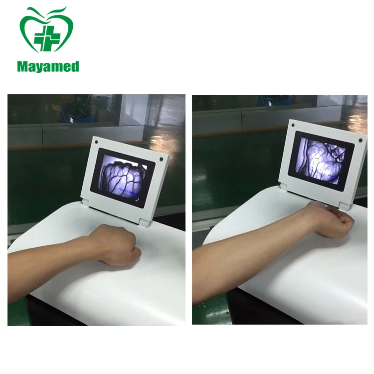 MY-G061D China Good Examination Therapy Equipments Portable Infrared Medical Vein Finder