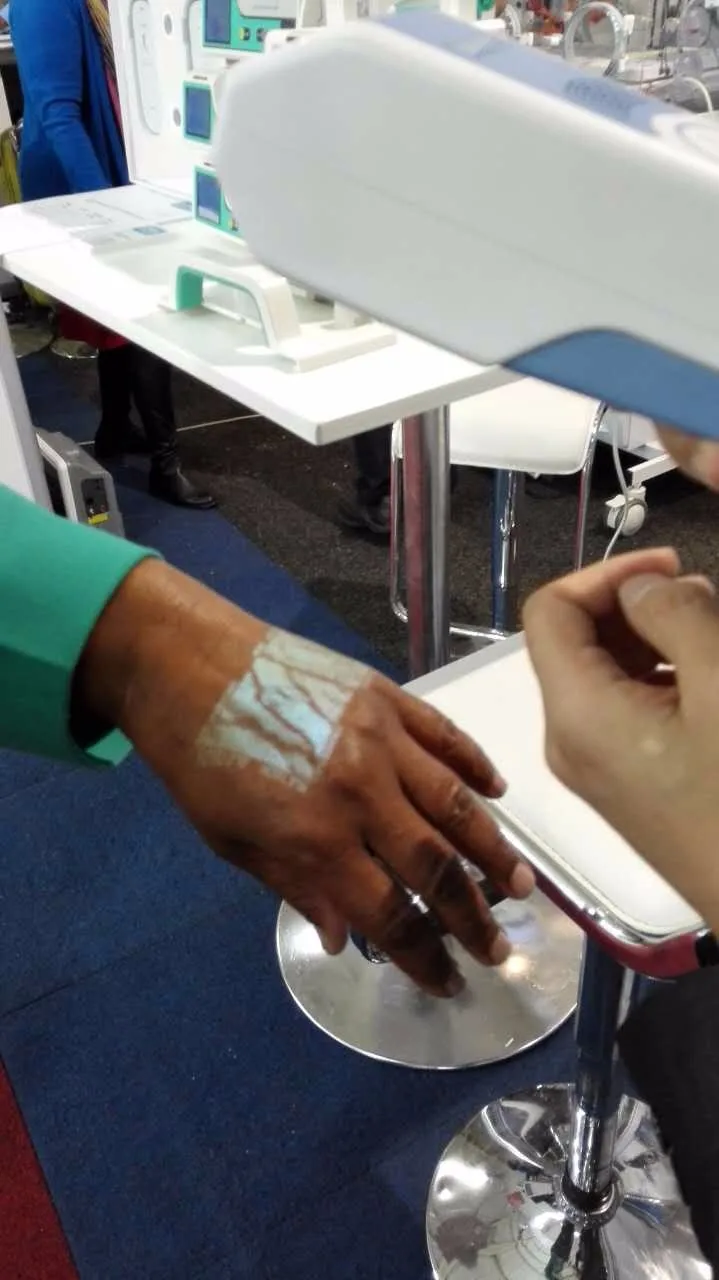 Vein Finder/Scanner/Viewer/Locator/Reader