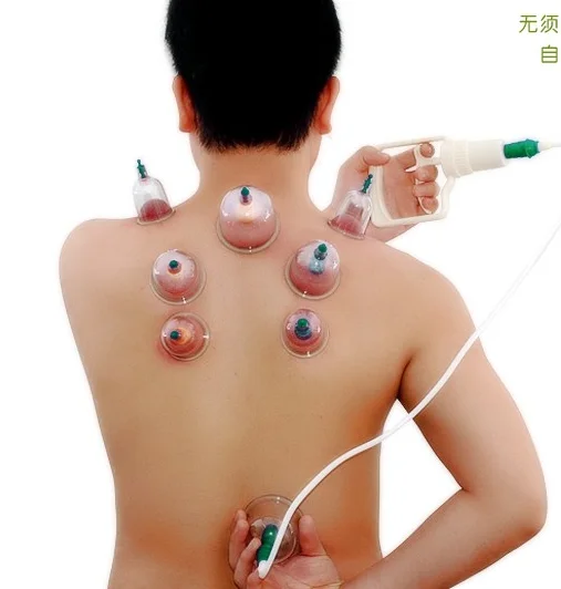
cheap sell product chinese single vaccum cupping single cupping 