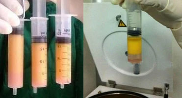 swing out centrifuge