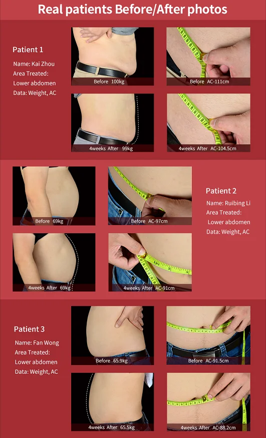 Laser beauty equipment 1060nm diode lipo laser fat removal body sculpting machine