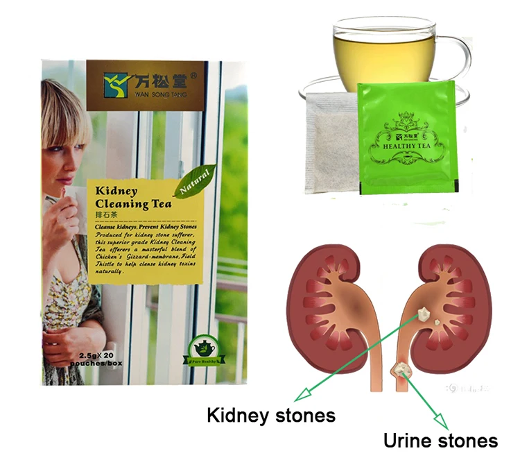 kidney stone cleanse